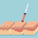 Etapele procesului de injectare a fundațiilor